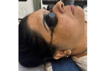 Hydra Facial
