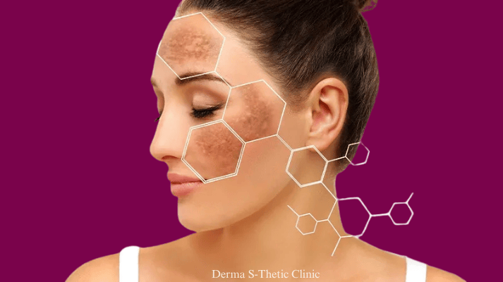 laser-hair-removal treatment